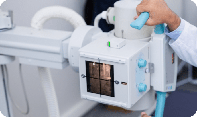 デジタルX線装置の写真